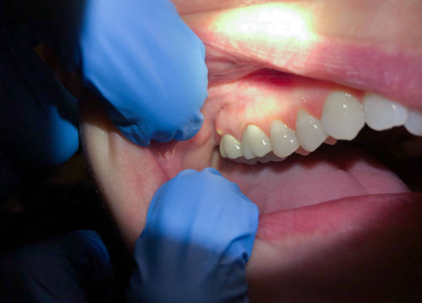 Best Emergency Treatment for Toothache in Seward, NE